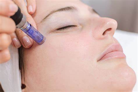 Microneedling PRO Course