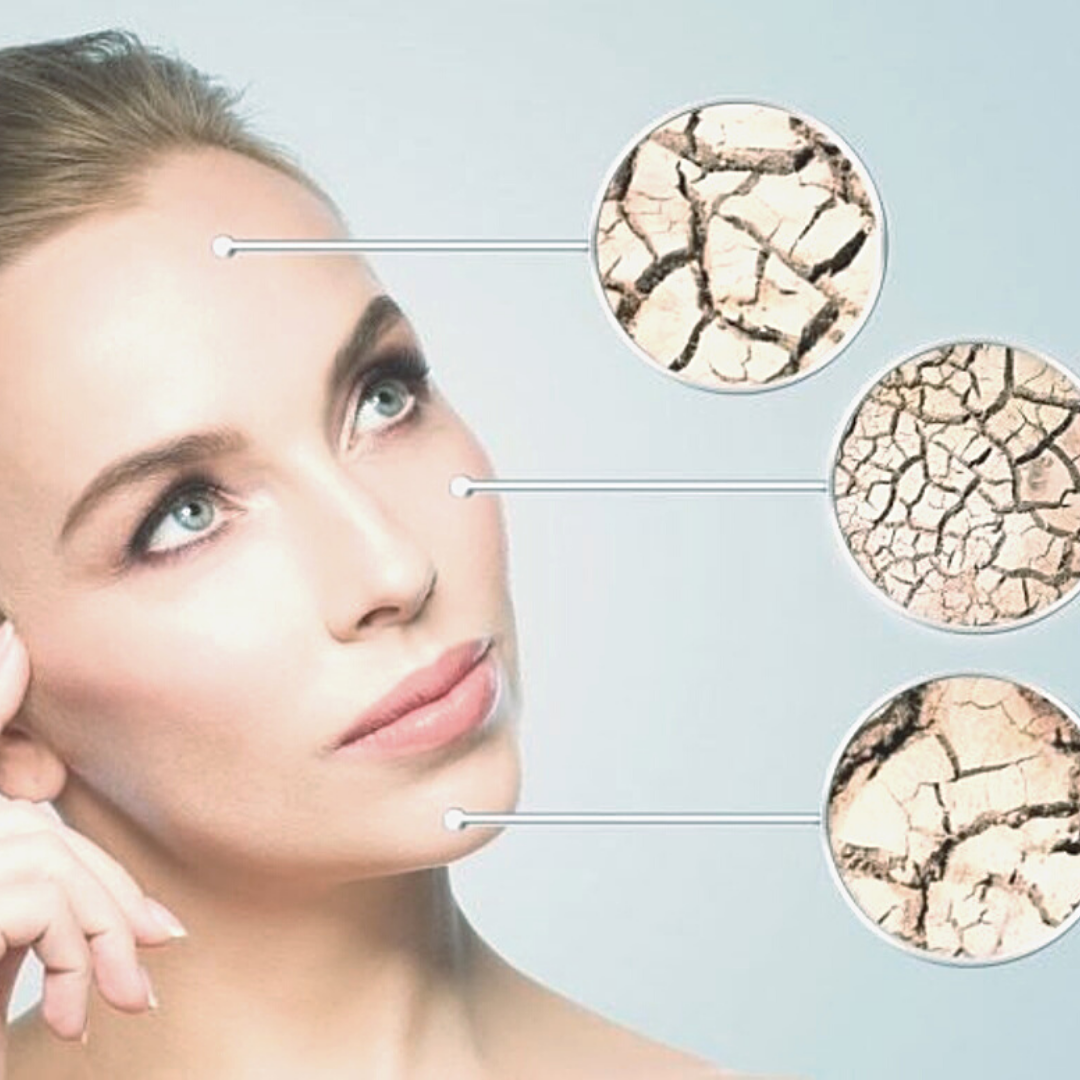 SKIN TYPE: DRY VS DEHYDRATED ONLINE COURSE – Skin Perfect Academy